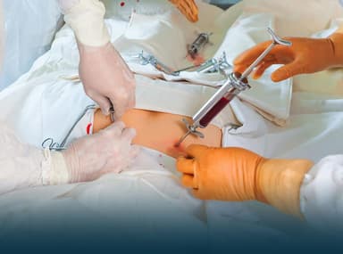 Peripheral Blood Stem Cell (PBSC)